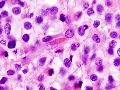 Zoom, bemærk de uregelmæssige celle- og kerneformer.