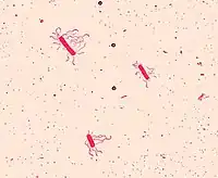 Bacillus cereusLeifson flagella farvning.