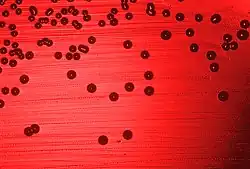 Haemophilus influenzae dyrket på blodagar.