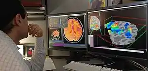 Researcher checking fMRI images