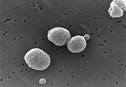 Streptococcus pneumoniaeunder elektronmikroskop