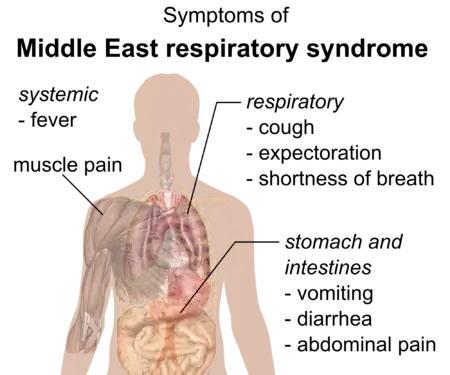 Symptomer på sygdommen MERS
