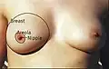 Bryst (Breast), Areola, brystvort (nipple)