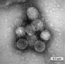 Transmissions-elektronmikroskopi af HCoV-NL63