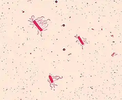 Bacillus cereusLeifson flagella farvning.