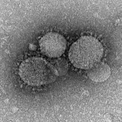 MERS-CoV-partikler set med elektronmikroskop. Viruspartiklerne har karakteristiske kronelignende pigge på membrankappen 
Tilhører virusgruppe IV