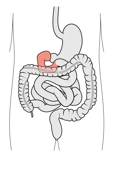 Tractus intestinalis duodenum